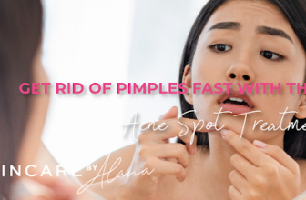 5 In a single day DIY Zits Spot Therapies and Merchandise