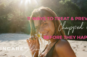 Chapped Lips Therapies | Prevention and Dwelling Treatments