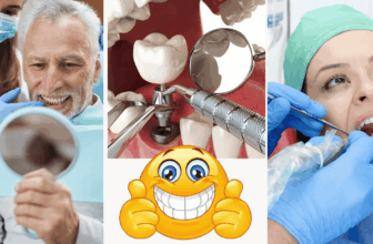 All On 4 Implants: Earlier than, Throughout, And After Care