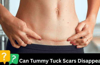 Do Tummy Tuck Scars Disappear—Or Can They Change into a Masterpiece?
