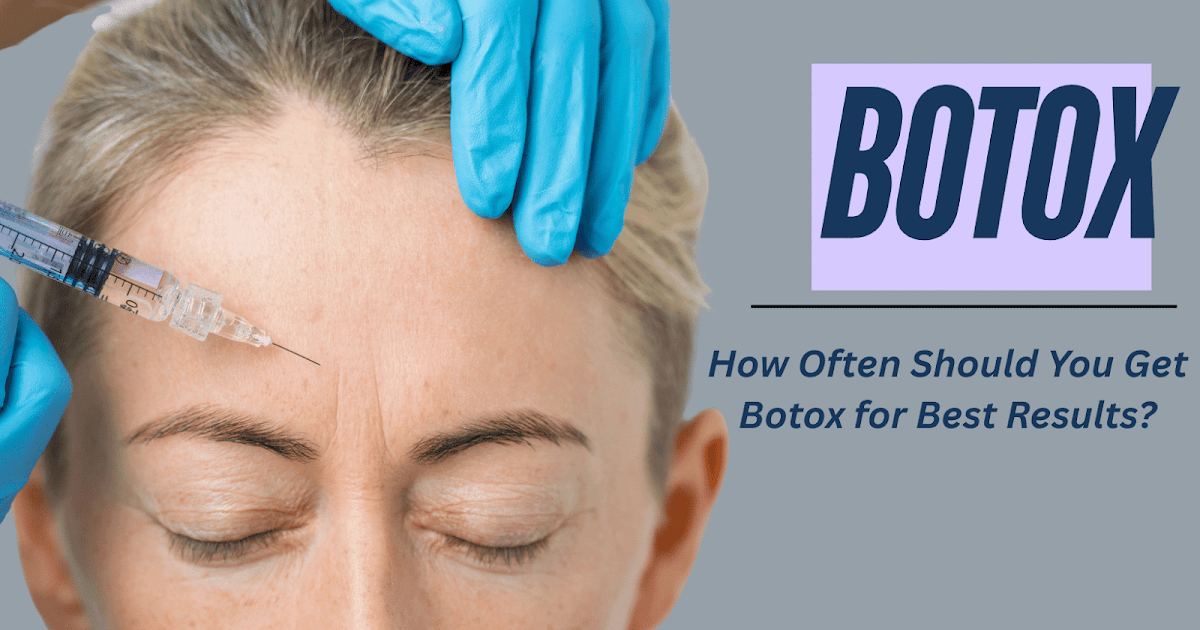 How Typically Ought to You Get Botox for Finest Outcomes?