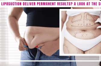 Does Liposuction Ship Everlasting Outcomes? A Take a look at the Science